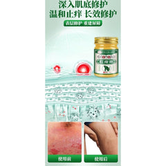 Hong Kong Anal Itching Cream 35g Skin Itching