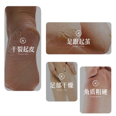 梵飞丝 山羊奶烟酰胺足膜 35克/1对