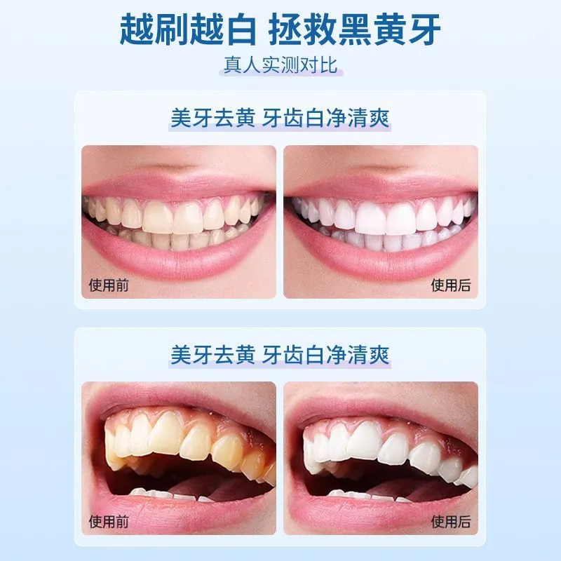 VSHELL Tooth Powder Whitening Nicotinamide Sea Salt Baking Soda for Stain 50g